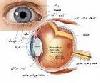 فوق تخصص شبکیه چشم پزشک